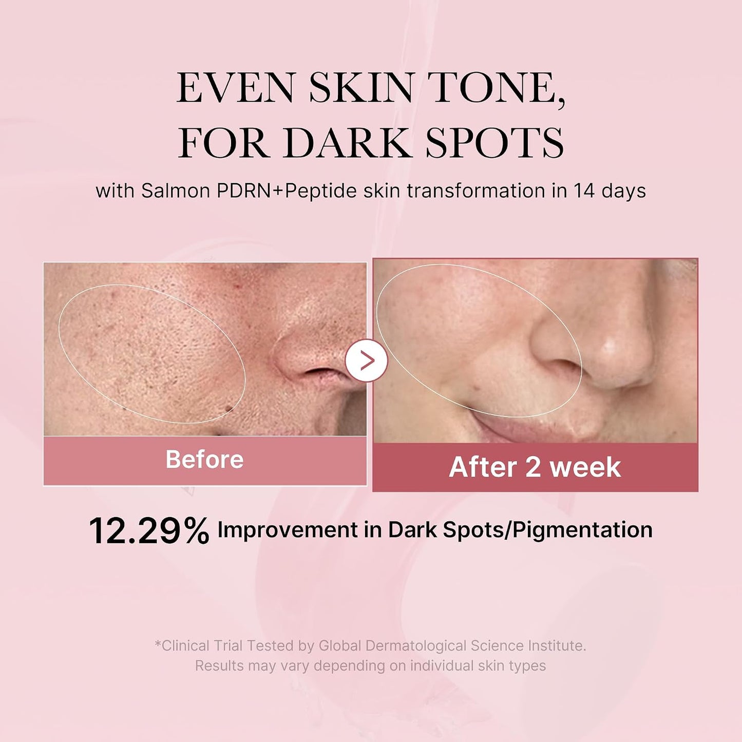 medicube Salmon DNA PDRN Pink CICA Soothing Toner I Pink Glow Toner to Stimulate, Soothe and Soothe Skin, Uneven Complexion, Peptide and Niacinamide, Korean Skin Care (250ml)